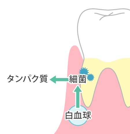 歯茎の健康に関する項目